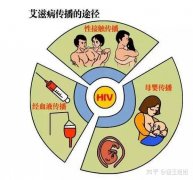 “性行为”是如何传播艾滋病的？