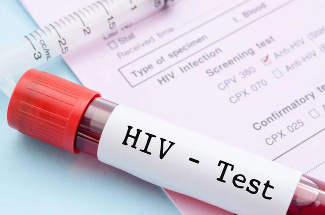 hiv病毒 世界上首位HIV感染治愈者去世了，这里是他的故事