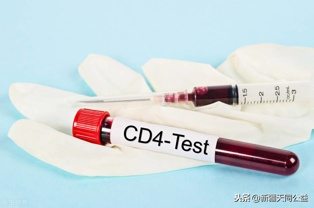 如何通过CD4和病毒载量看HIV治疗效果?