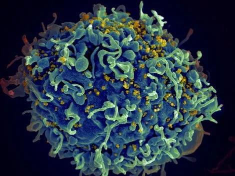 ▲HIV（黄色颗粒）感染表达CD4的免疫T细胞（图片来源：NIH）