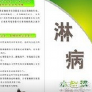 感染淋病后的症状是什么感染淋病后的表现