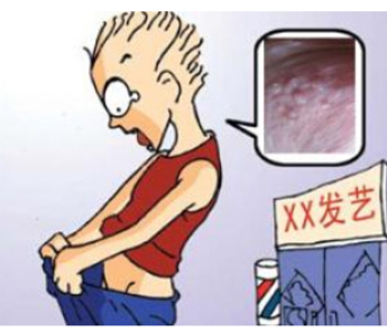 肛门尖锐湿