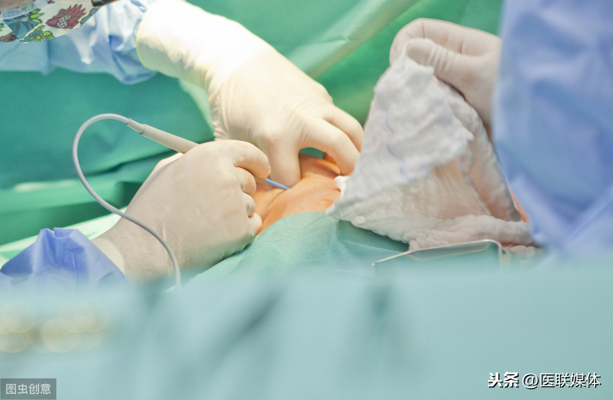身体同时出现这3个问题，十有八九，是肛门尖锐湿疣在“捣鬼”