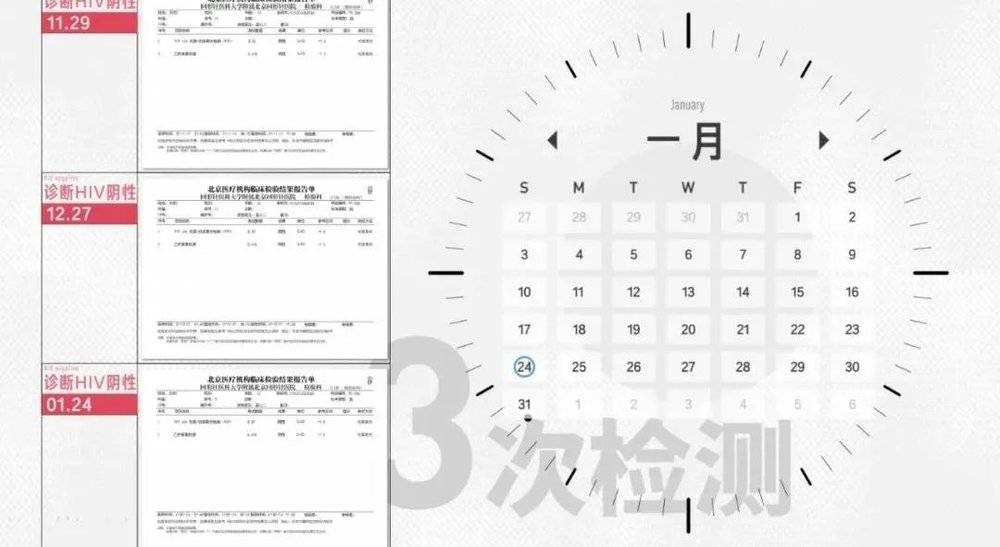 hiv病毒