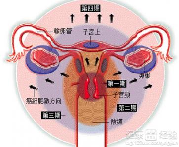 宫颈尖锐湿疣有哪些症状_宫颈尖锐湿疣_宫颈尖锐湿疣怎么治