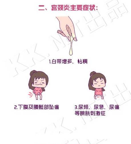 支原体感染 女性查出支原体感染该怎么办？谨记这2点，夫妻双方都要小心