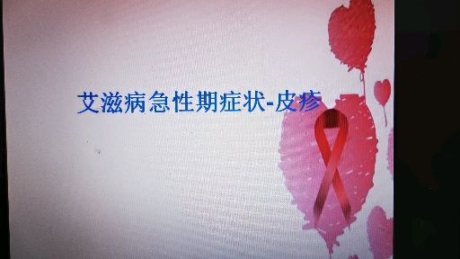 世界艾滋病日和世界禁毒日_世界艾滋病日_12月1日世界艾滋病日