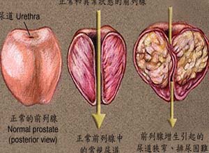 男性支原体是什么病