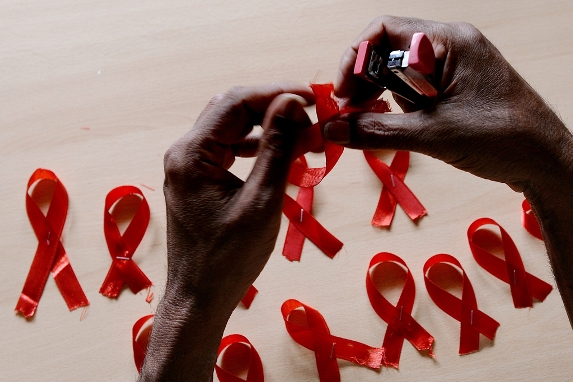 感染艾滋病多久出现症状_艾滋病 感染几率_感染艾滋病