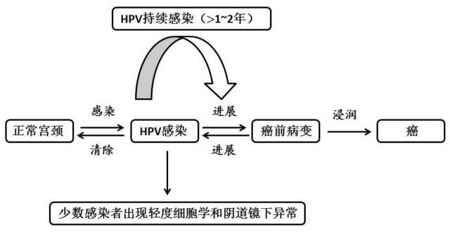 宫颈尖锐湿疣