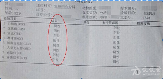 支原体感染塞什么药 介绍支原体感染的治疗方法更新时间:2018-06-25