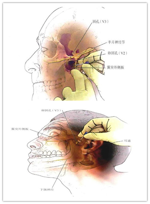 生殖器疱疹_怎样治疗生殖器疱疹_生殖器疱疹传染吗