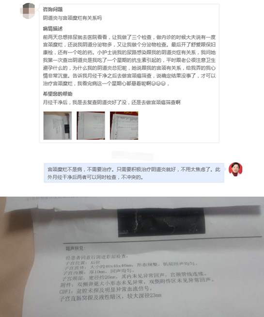 尖锐湿疣宫颈症状_宫颈尖锐湿疣_宫颈尖锐湿疣有什么症状