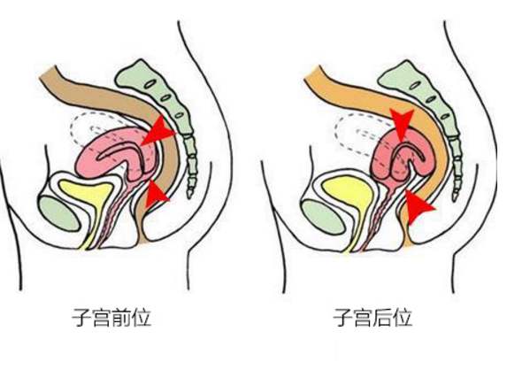 宫颈尖锐湿疣常见吗_宫颈尖锐湿疣有哪些症状_宫颈尖锐湿疣