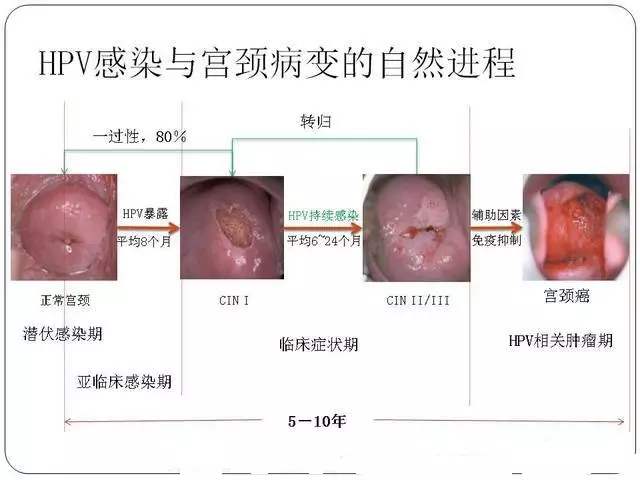 宫颈尖锐湿疣_宫颈尖锐湿疣常见吗_宫颈尖锐湿疣有哪些症状