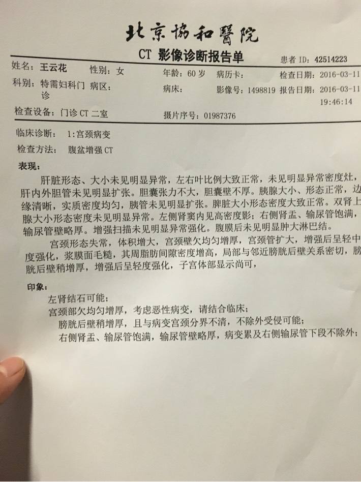 宫颈尖锐湿疣常见吗_宫颈尖锐湿疣的症状_宫颈尖锐湿疣