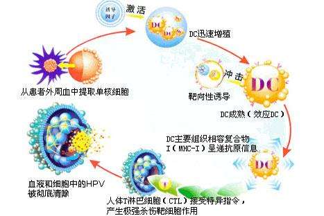 尖锐湿疣患者传染_尖锐湿疣患者_醋酸白试验 给尖锐湿疣患者带来的不良反应