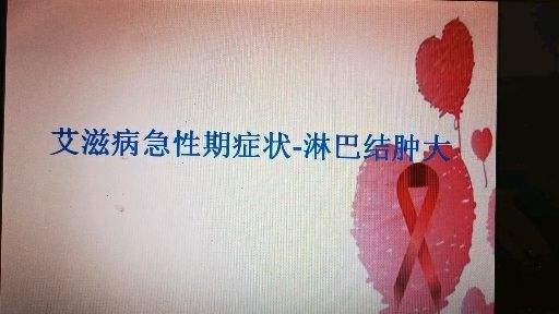 hiv病毒检测_hiv_hiv症状