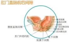 女性尖锐湿疣_女性尖锐湿疣能治愈吗_女性尖锐湿疣