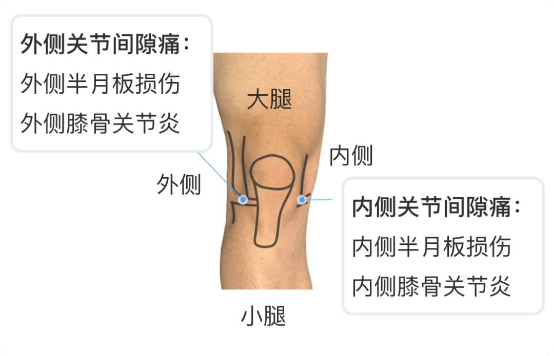 软下疳症状_软下疳怎么治疗_软下疳