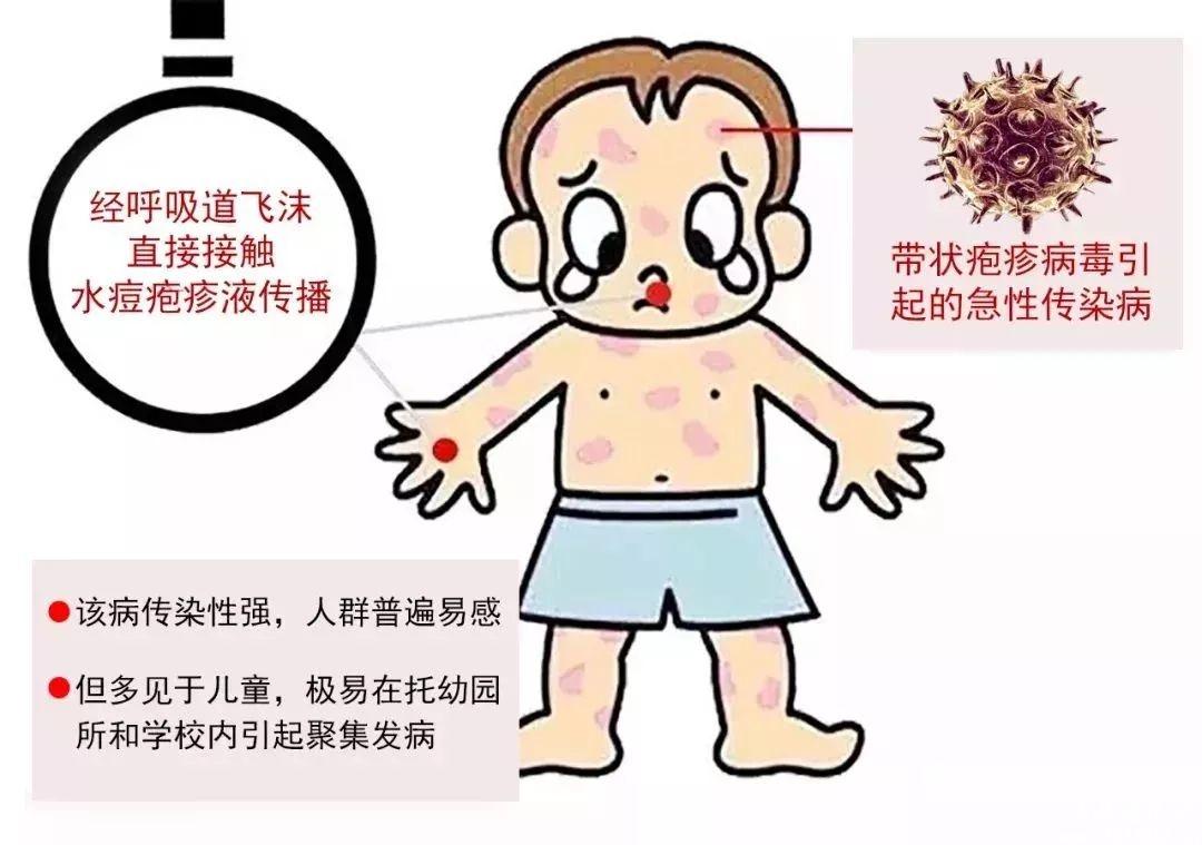 中医治疗生殖疱疹方法_生殖器疱疹_生殖疱疹