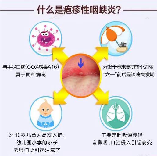 生殖疱疹感染症状_生殖器疱疹_生殖疱疹病毒感染