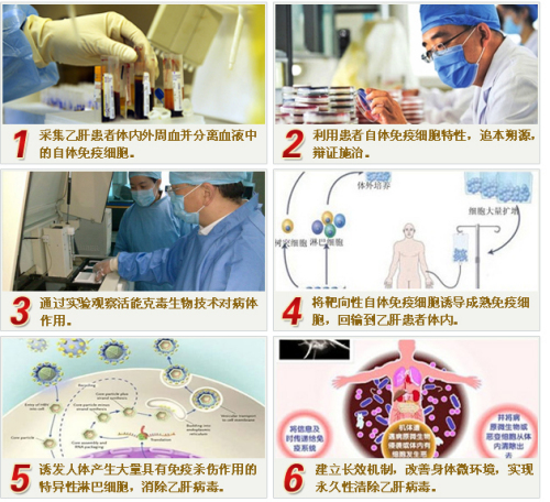 激活免疫排毒疗法：改变尖锐湿疣患者命运新疗法