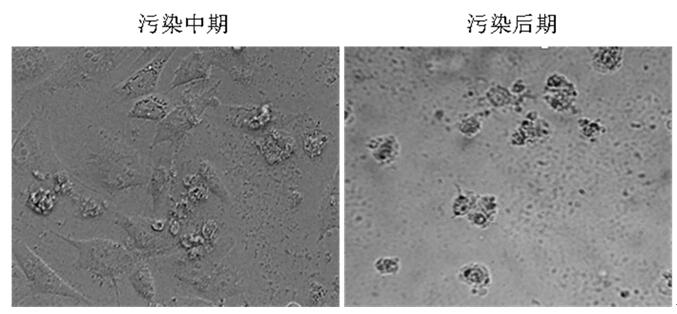 支原体依原体的感染原因_感染支原体的原因_支原体感染