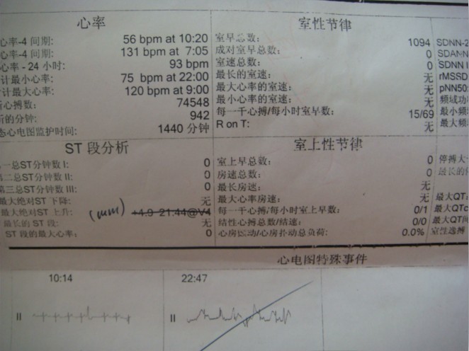 尖锐湿疣病毒_湿疣病毒怎么引起的_湿疣病毒是怎么引起的