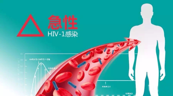 急性HIV-1感染