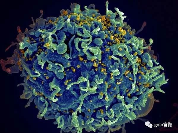 重磅！科学家已证实HIV病毒“藏身之处”，将消灭体内艾滋病毒