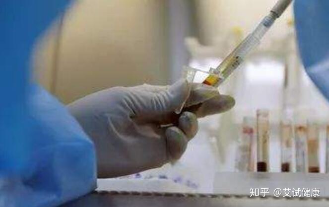哪些人必须做艾滋病检测