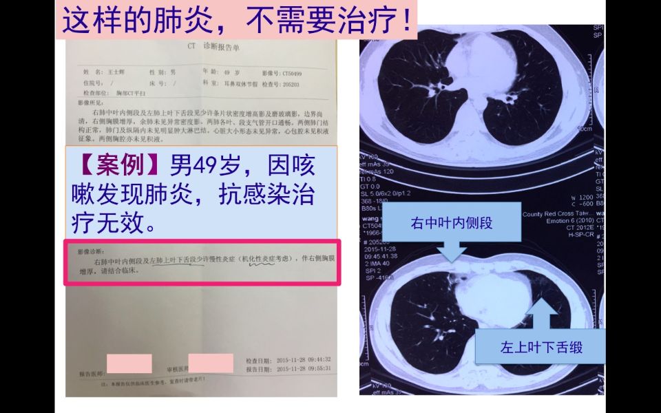 淋病_淋病 慢性淋病_淋病