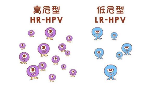 感染上HPV病毒，就一定得上尖锐湿疣吗？