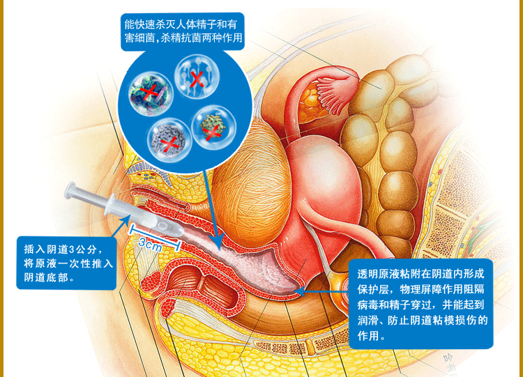 梅毒感染_梅毒 感染_感染梅毒