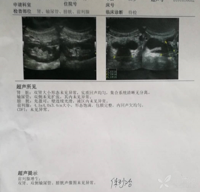 生殖支原体感染是什么意思