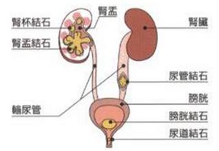 女性淋病症状_淋病淋病症状_淋病症状图片