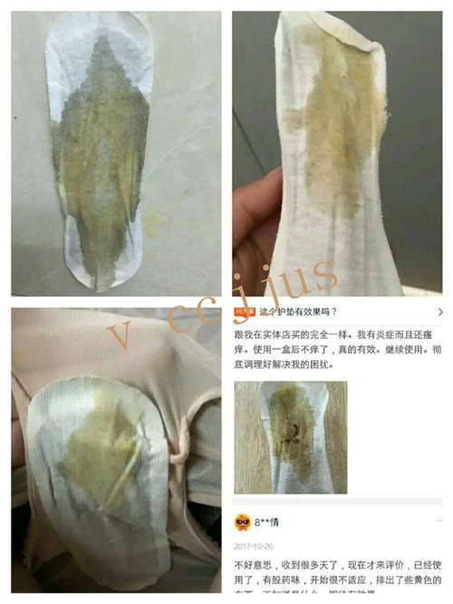 孩子感染支原体的症状_女性感染支原体衣原体的症状_支原体感染