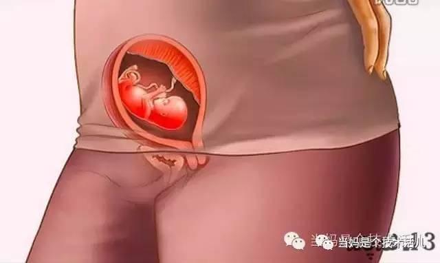 得了尖锐湿疣_尖锐怎么得_乳房得尖锐湿疹图片