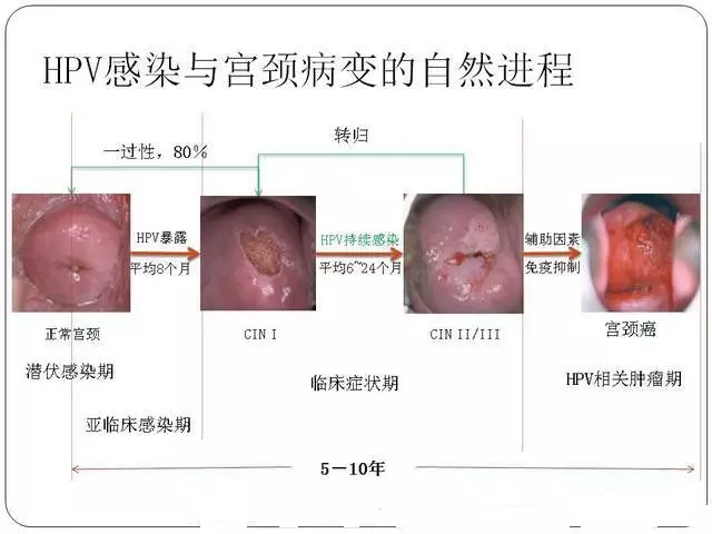 宫颈尖锐湿疣_宫颈湿疣的危害_宫颈湿疣怎么引起的