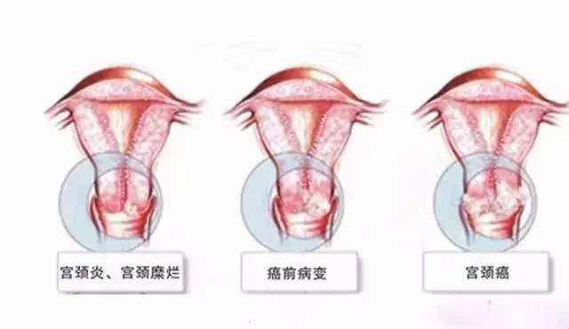 孩子感染支原体的症状_感染支原体的原因_支原体感染