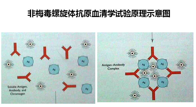 哪种检测梅毒的方法最靠谱？最精确？