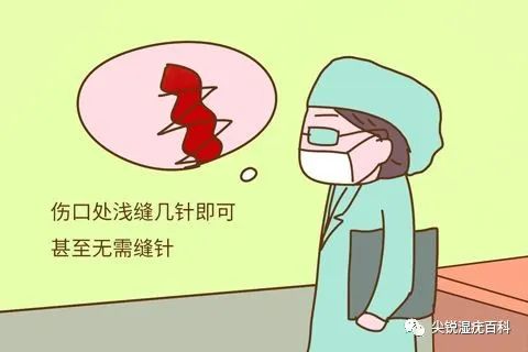 女性尖锐湿疣的症状都有哪些特征，怎么判断得了尖锐湿疣