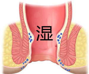 肛门长尖锐湿疣症状