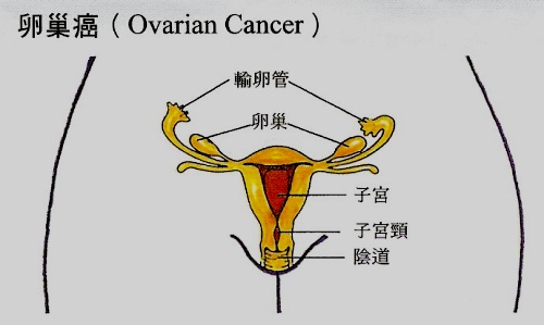 体检能够检查出淋病吗