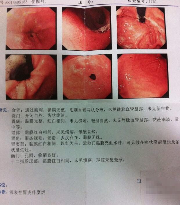 01 接触多久得淋病？