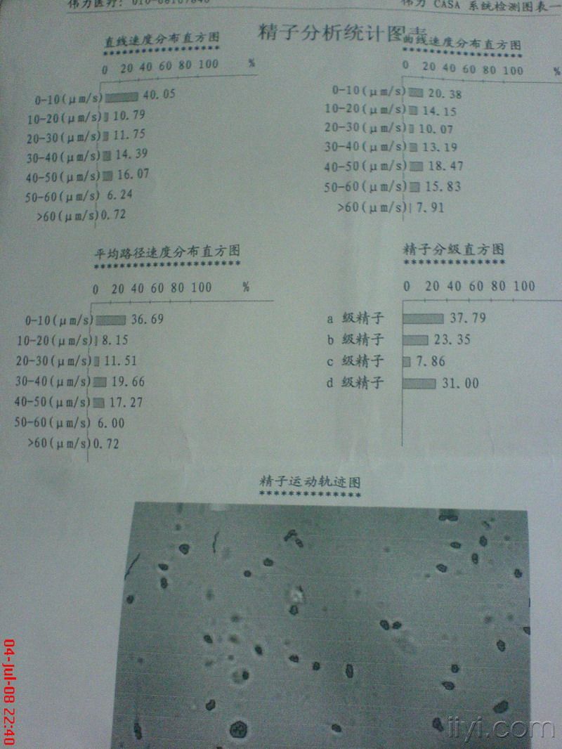 支原体感染_女性支原体阳性感染_女性感染支原体衣原体的症状