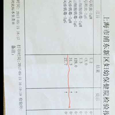 中药杀hiv病毒_eb病毒和hiv病毒一样么_hiv病毒