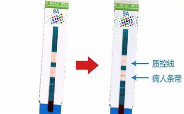 艾滋病试纸有假阳吗?