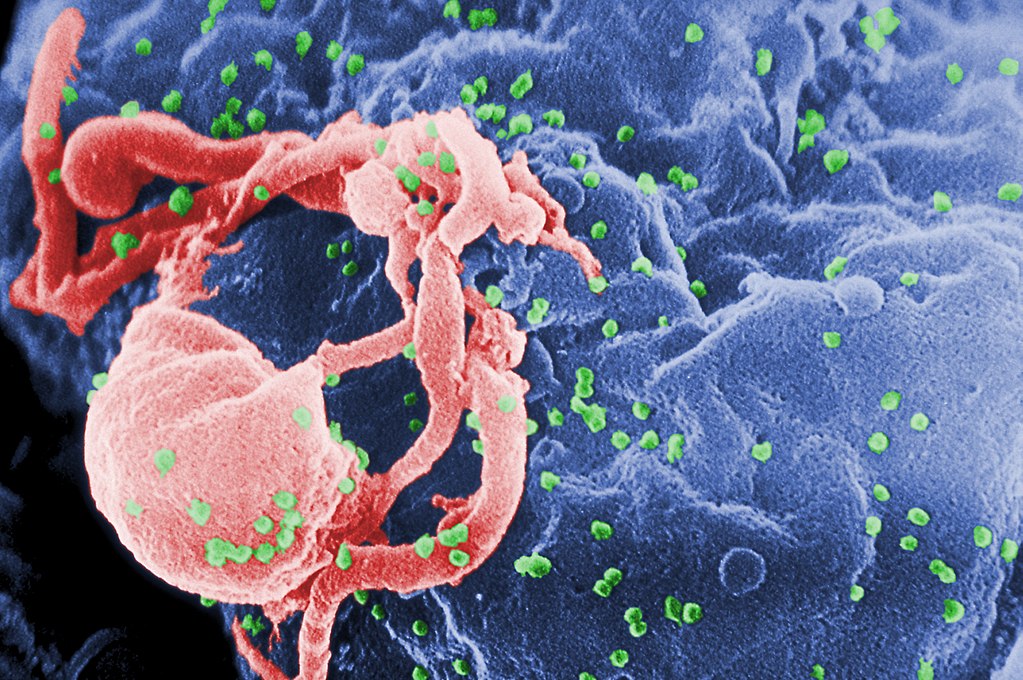 图注：HIV-1的扫描电子显微照片